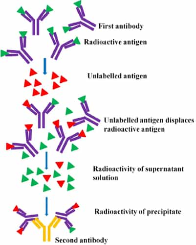 RIA Full Form: Definition, Principles, Types & Role In Life Science!